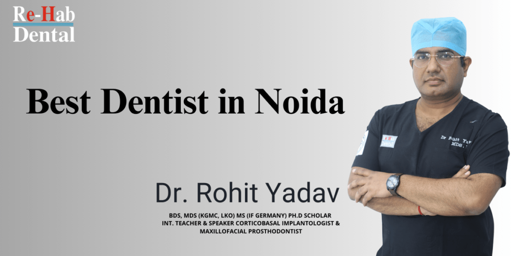 Finding The Best Dentist In Noida Is Easy
