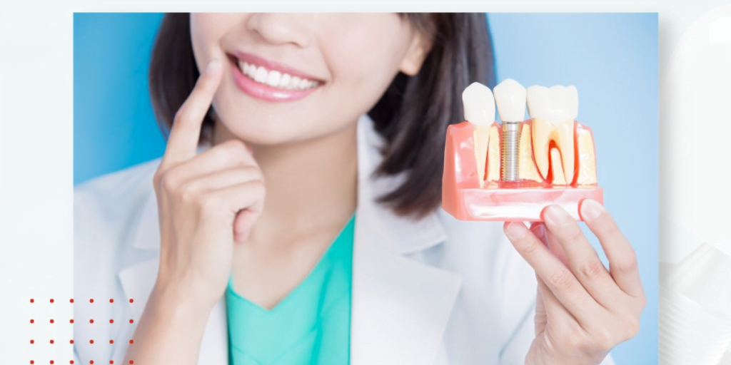 Exploring The Art And Science Of Dental Implantology