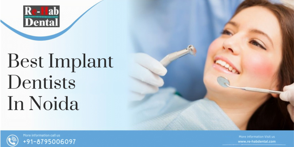 Types Of Dental Implants And Best Implant Dentists In Noida