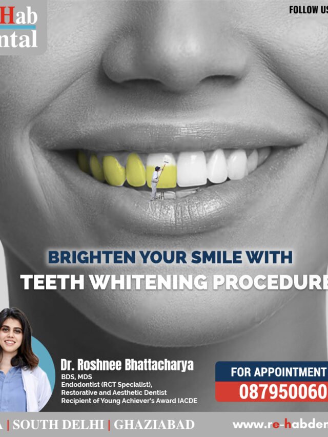 Brighten Your Smile with Teeth Whitening Procedure – Reveal Your Perfect Smile!