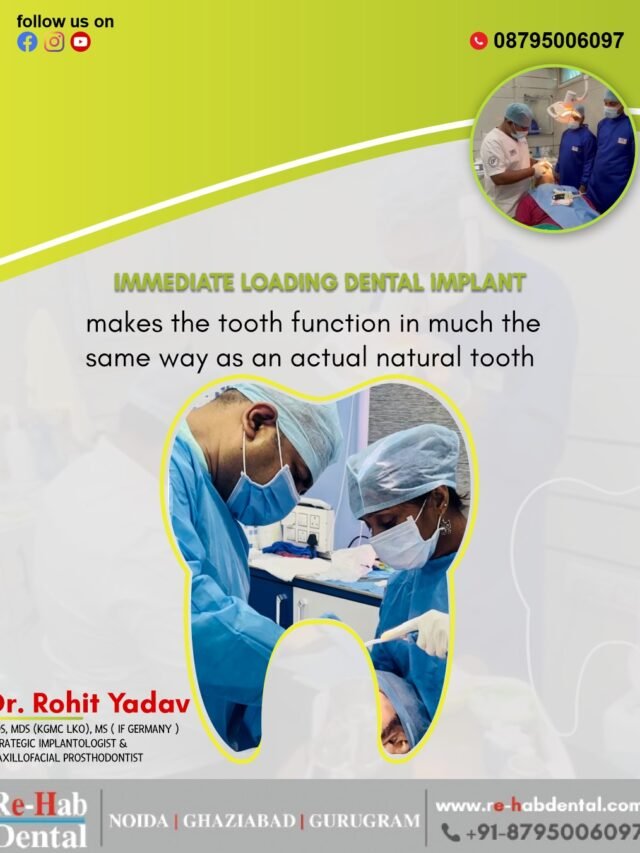 Best Dental Surgeon in Noida Dr Rohit Yadav – Redefining Dental Excellence